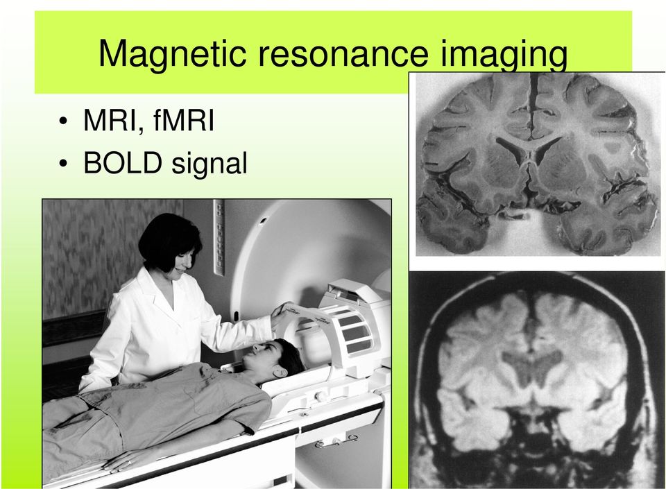 imaging MRI,