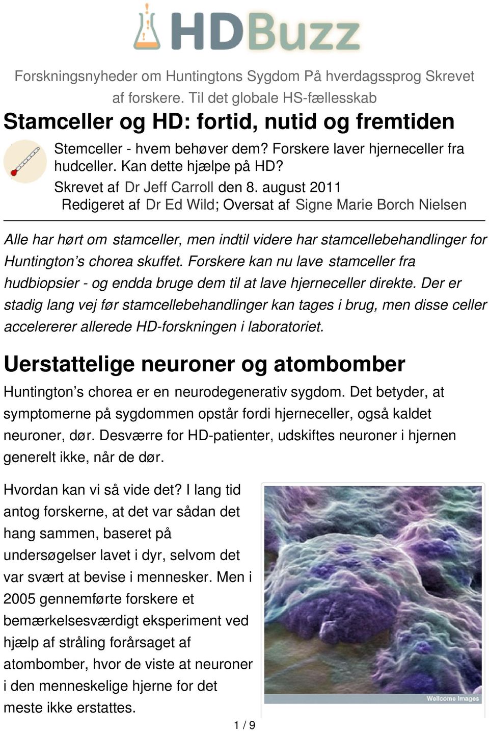 august 2011 Redigeret af Dr Ed Wild; Oversat af Signe Marie Borch Nielsen Alle har hørt om stamceller, men indtil videre har stamcellebehandlinger for Huntington s chorea skuffet.