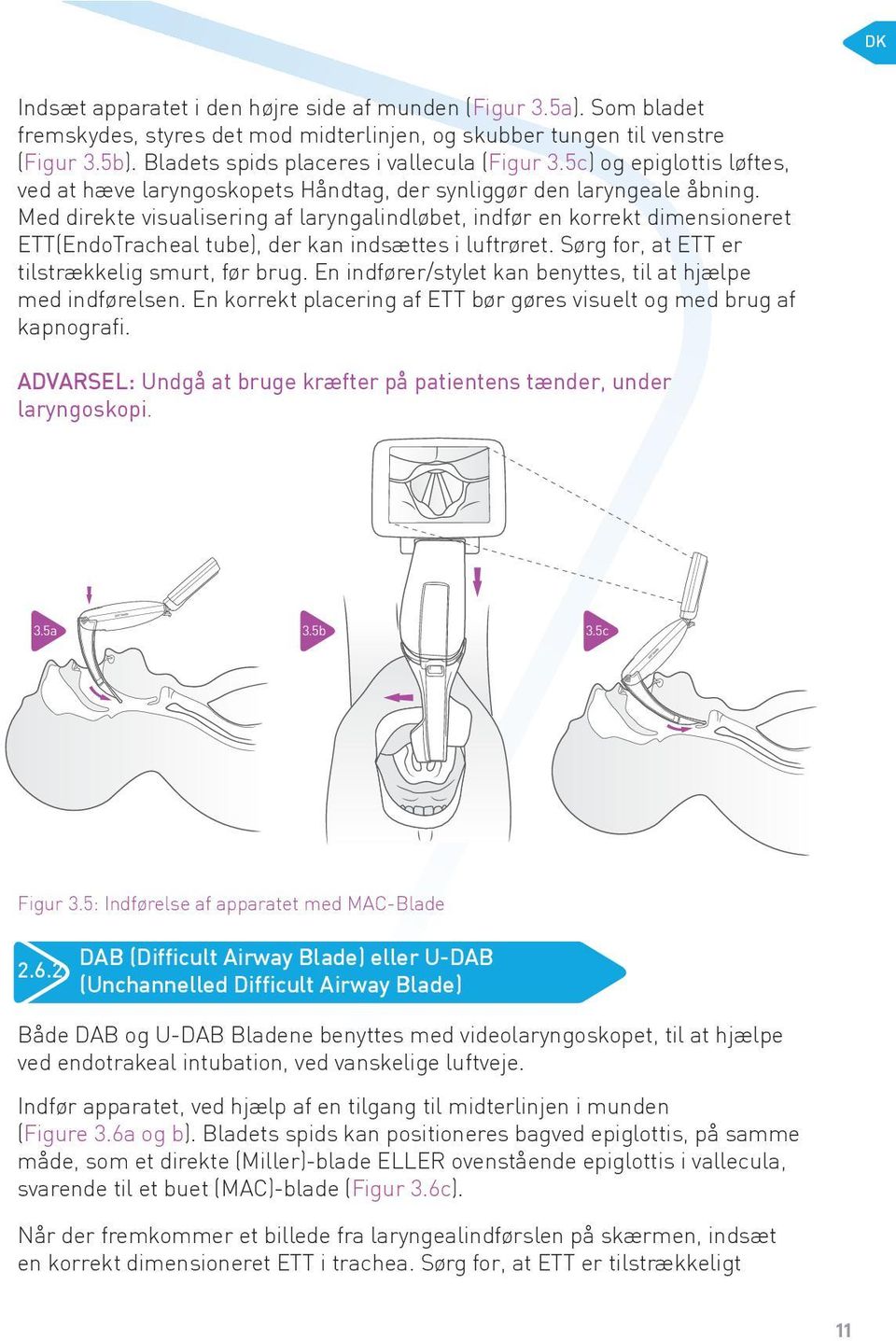 Med direkte visualisering af laryngalindløbet, indfør en korrekt dimensioneret ETT(EndoTracheal tube), der kan indsættes i luftrøret. Sørg for, at ETT er tilstrækkelig smurt, før brug.