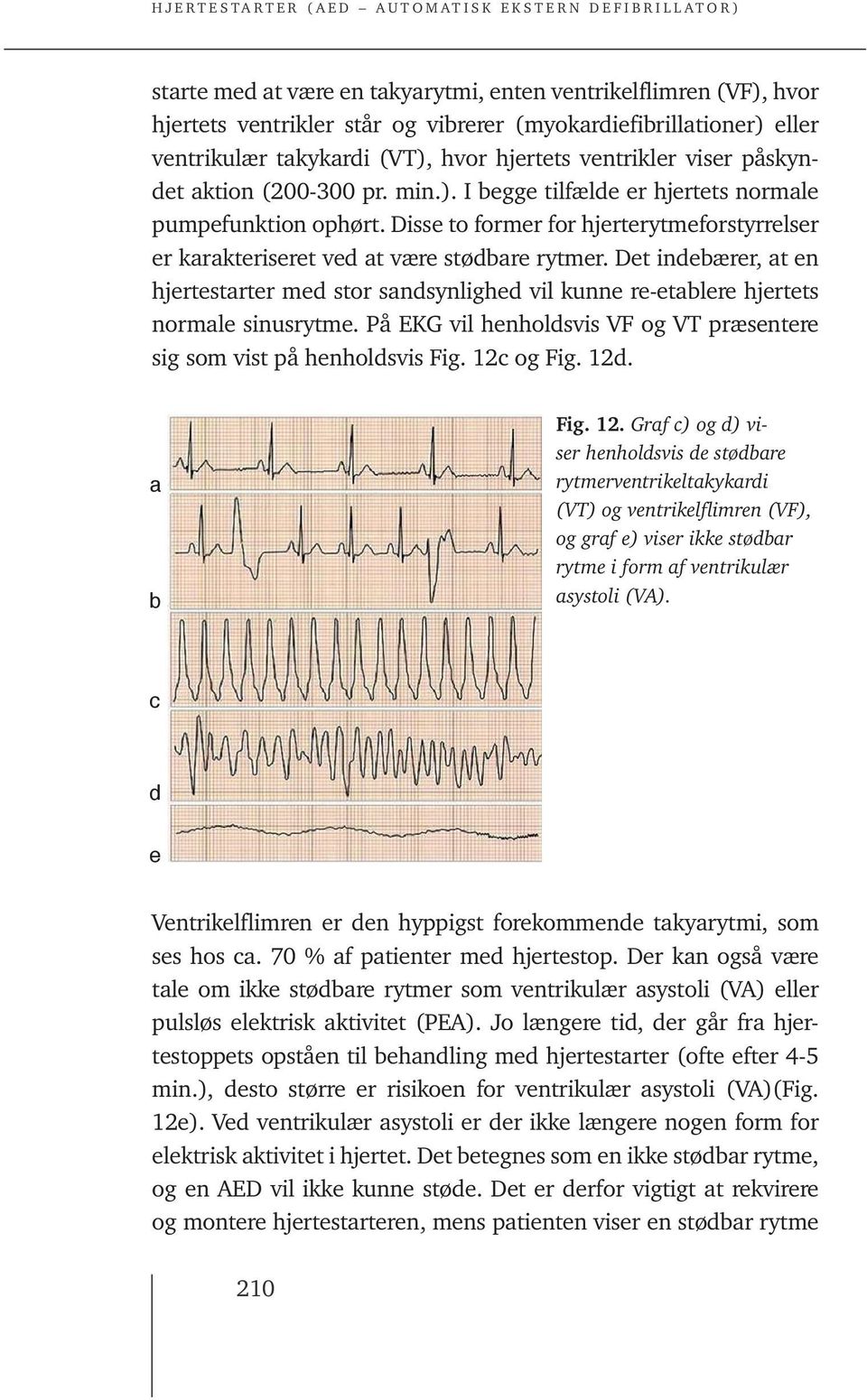 Det indebærer, at en hjertestarter med stor sandsynlighed vil kunne re-etablere hjertets normale sinusrytme. På EKG vil henholdsvis VF og VT præsentere sig som vist på henholdsvis Fig. 12c og Fig.