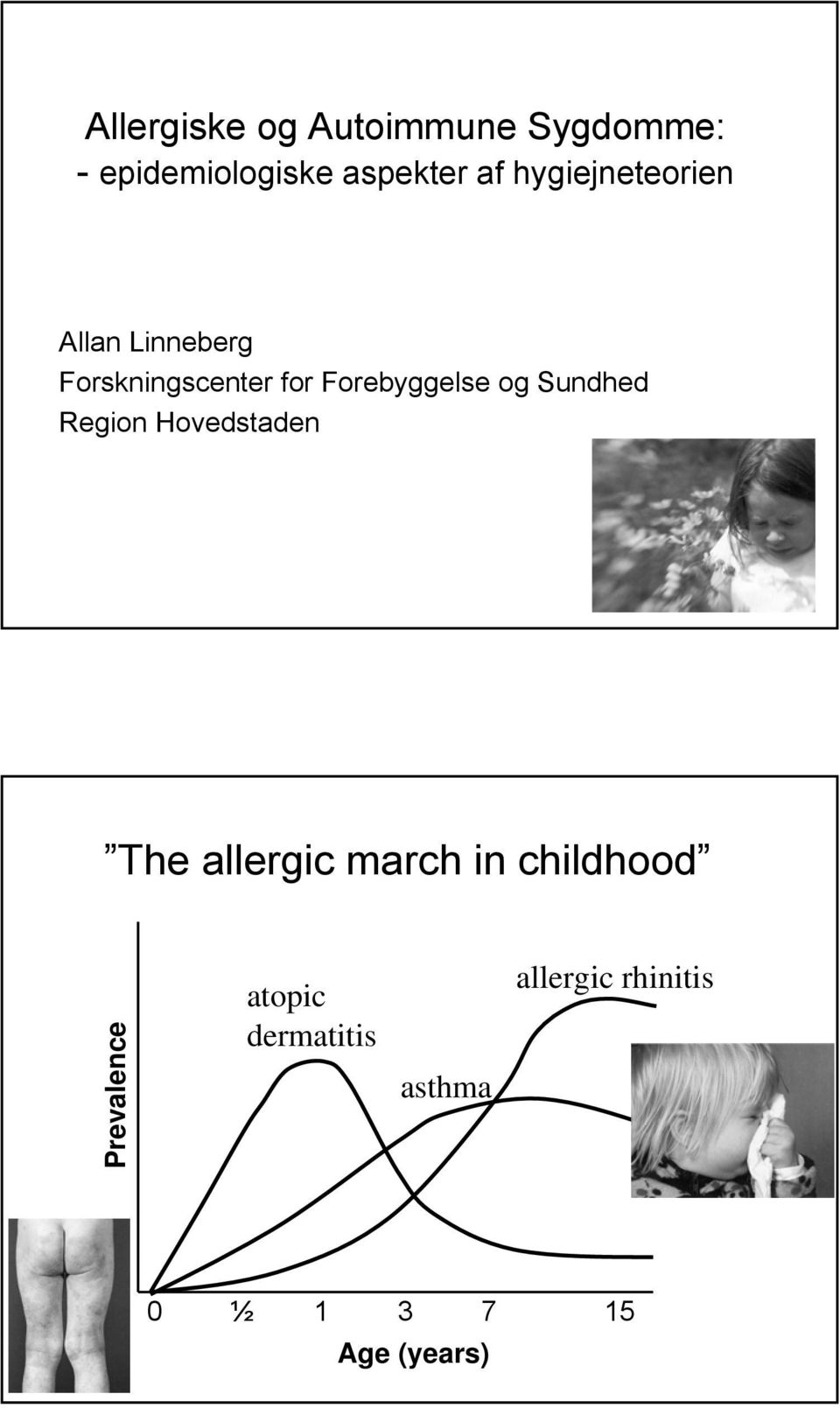 og Sundhed Region Hovedstaden The allergic march in childhood