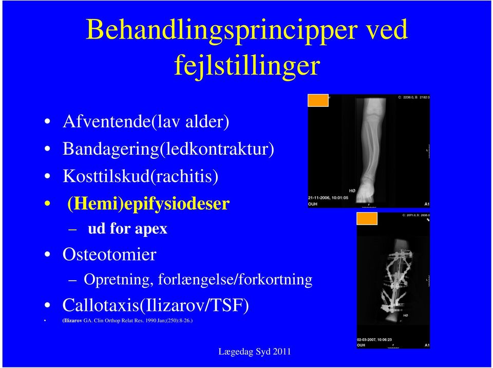ud for apex Osteotomier Opretning, forlængelse/forkortning