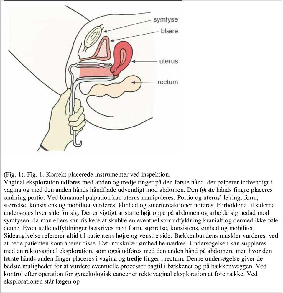 Den første hånds fingre placeres omkring portio. Ved bimanuel palpation kan uterus manipuleres. Portio og uterus lejring, form, størrelse, konsistens og mobilitet vurderes.