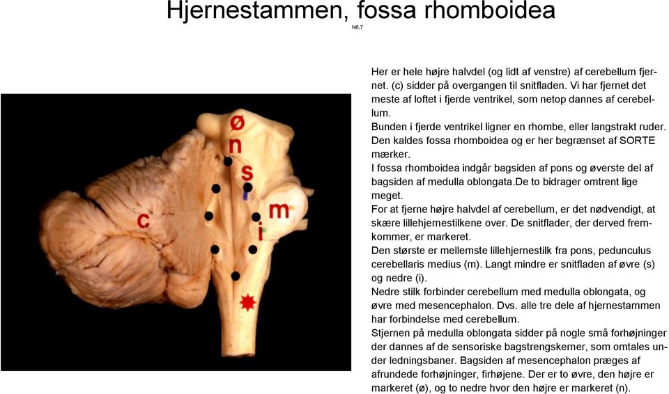Den kaldes fossa rhomboidea og er her begrænset af SORTE mærker. I fossa rhomboidea indgår bagsiden af pons og øverste del af bagsiden af medulla oblongata.de to bidrager omtrent lige meget.