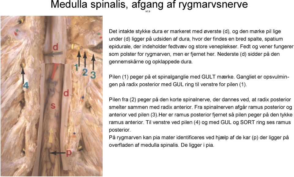 Pilen (1) peger på et spinalganglie med GULT mærke. Gangliet er opsvulmingen på radix posterior med GUL ring til venstre for pilen (1).