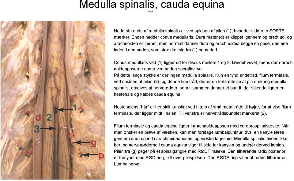 Conus medullaris ved (1) ligger ud for discus mellem 1.og 2. lændehvirvel, mens dura-arachnoideaposerne ender ved anden sacralhvirvel. På dette lange stykke er der ingen medulla spinalis.