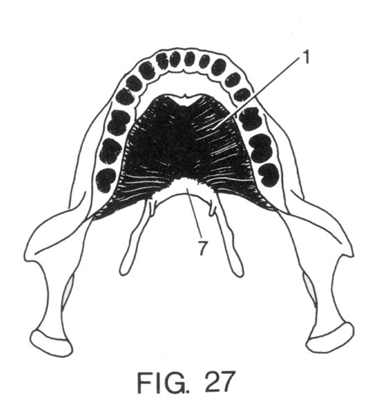 Suprahyoide muskler m. mylohyoideus m. geniohyoideus m. digastricus venter anterior m. digastricus venter posterior m.