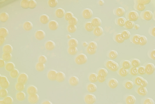 Pseudomonas aeruginosa Ps. aeruginosa er tynde bevægelige Gram-negative stave. Bakterien vokser med gråhvide/ grønlige kolonier. Ofte vil agaren få en grønlig farve, og pladen vil have en sødlig lugt.