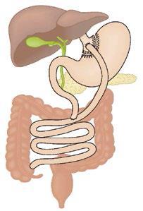 er foreligger ikke sammenlignende studier mellem OGTT værdier for RYGBopererede og ikke-opererede Kvinder med tidligere Gastric Bypass har øget risiko for intern herniering under graviditeten.
