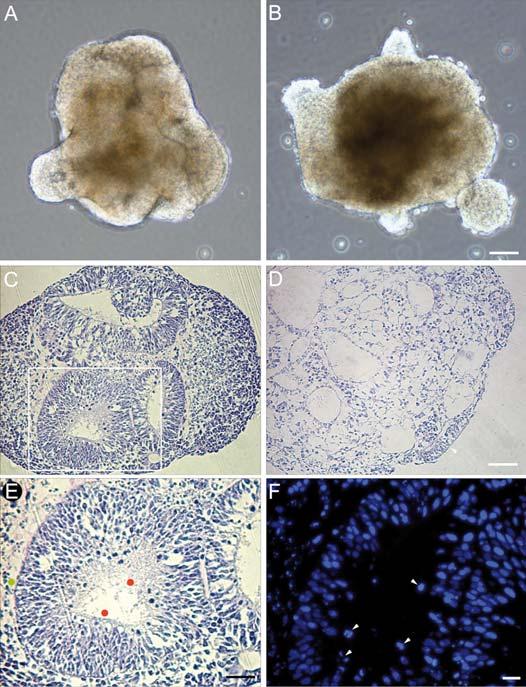 802 Fig. 2. Fra kraterceller udviklede hes-cellers uddifferentiering i et Med-2-medium. Embryoid bodies i serumfri suspension, med (A) og uden (B) Med-2-medie.