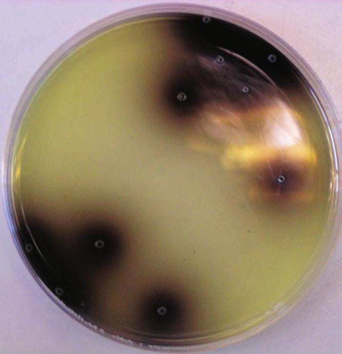 Er Listeria monocytogenes indenfor og udenfor de samme? For at undersøge hvor mange og hvilke typer af L.