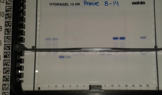 absorbans Bioanalytikeruddannelsen Bachelorprojekt 20-12-2016 Fig. 6: Resultater af gelelektroforese på Hydrasys2. Tv. færdig gel med prøve afsat i spor 1-3. Th. færdig gel i migrationsmodulet.