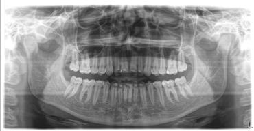 5 Betjening Sirona Dental Systems GmbH 5.1 Oprettelse af røntgenoptagelse Brugsanvisning ORTHOPHOS SL 2D / 3D 5.1.2 Valg af optageprogram 5.