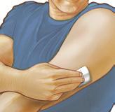 Undgå områder med ar, modermærker, strækmærker eller knuder. Vælg et område af huden, som normalt forbliver fladt i løbet af dine daglige aktiviteter (uden at bøje eller folde).
