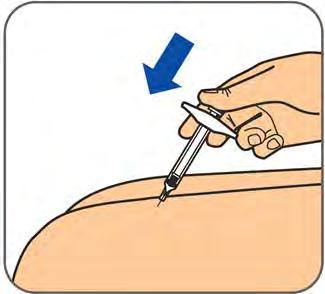 Kanylehætten må ikke sættes på igen. Trin 4: Klem forsigtigt en hudfold sammen på det rengjorte injektionssted.