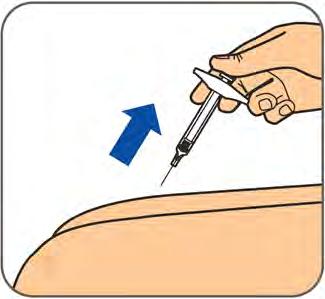 Trin 6: Når injektionssprøjten er tom, tager du kanylen ud af huden i samme vinkel, som den blev indført. Sæt aldrig hætten på kanylen igen. Du kunne komme til at stikke dig selv.