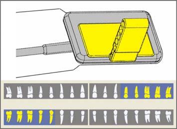 Sæt den gule visirring (B) på den dobbelt vinklede føringsstang (C). 2. Sæt den gule sensorholderklap (A) på føringsstangen (C). 3.