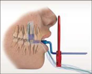 Positionér sensoren centralt i mundhulen, uden at ganen berøres i den forbindelse. 3.