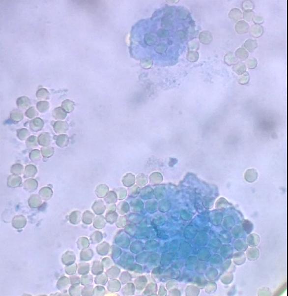 Side 13 Blodceller Materialer: Steril lancet eller nål, objektglas og dækglas, mikroskop, methylenblåt opløsning.