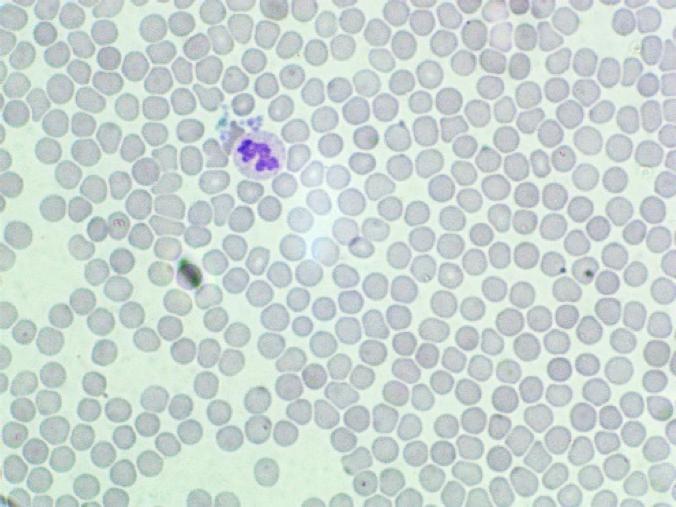 En dråbe blod presses ud på et objektglas. Læg dækglas på og mikroskopér.
