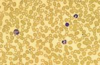 Hvad er myelomatose? 3 Blodet indeholder tre forskellige slags blodlegemer: Hvide blodlegemer. Deres opgave er at forsvare kroppen mod virus og bakterier.