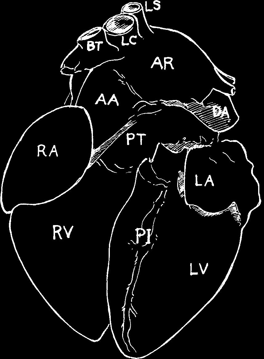 brachiocephalic trunk, LC = left common carotid artery, LS = left