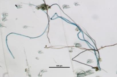 AARHUS UNIVERSITY Undersøgelser af kilder og forekomst til mikroplast i