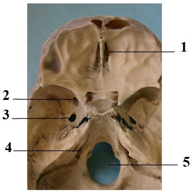 Opgave 3 Kraniet A. Identificer de nedenfor markerede foramina (huller) i kraniet. 1. 2.