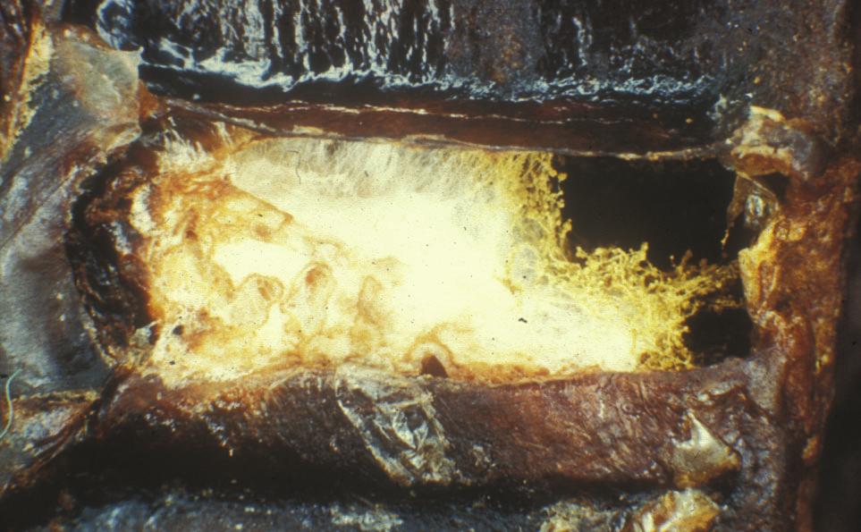 STENYNGEL SKADEVOLDER Stenyngel forårsages af skimmelsvampen Aspergillus flavus. Både voksne bier og bi-larver kan smittes. Infektionen begynder ved, at sporer af svampen indtages gennem foder.