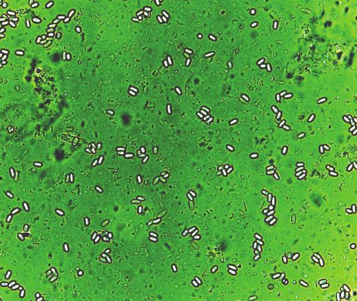 NOSEMA Foto: Wolfgang Ritter SKADEVOLDER Nosema, hvis latinske navn er Nosema apis, er en såkaldt mikrosporidie. Mikrosporidier er meget små encellede organismer, som er i stand til at danne sporer.