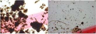 Metoder til detektion af mikroplast Detektionsmetoder Lysmikroskopi Spektroskopi (kemisk fingeraftryk) FTIR (fourier transform infrared