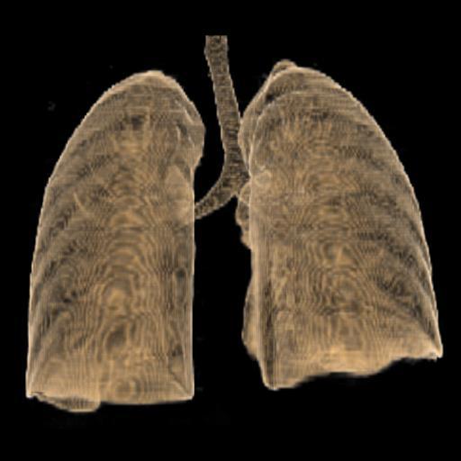 Lungernes topografi og relationer : CT 3D Apex pulmonis. Basis pulmonis.