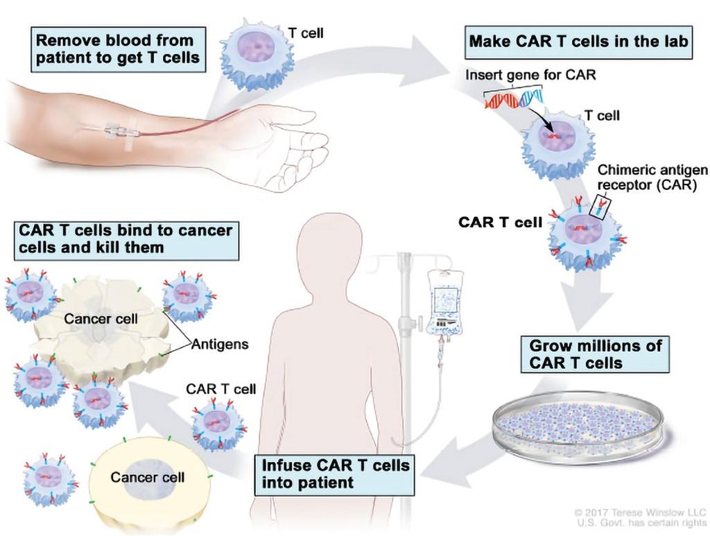 Cellebaseret immunterapi Den traditionelle cancerbehandling Ilustration af CAR-T celleparti Den traditionelle behandling af cancersygdomme har i mange år bestået af kombinationer af kemoterapi,