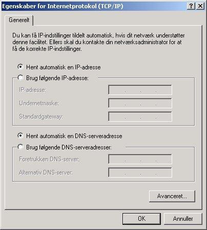 I vinduet Status for LAN-forbindelse skal du klikke på Egenskaber. 4.