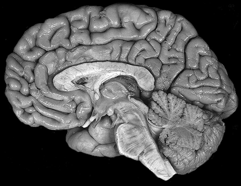 Hjernen Storhjernen Hjernebjælken Thalamus Nakkelappen (synscenter)