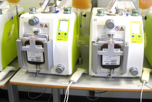 Blodkomponenter I samarbejde med blodbankens kvalitetslaboratorie, ændrede fraktioneringen produktionen af puljede trombocytkoncentrater (pool-tk) pr 1. juni 2017.