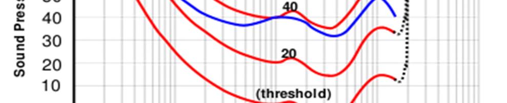 Her følges den røde kurve mærket 40 fra 1000 Hz ned af i frekvens til 100 Hz nås. Her aflæses, at lydtryksniveauet for de 100 Hz skal være ca. 61 db.