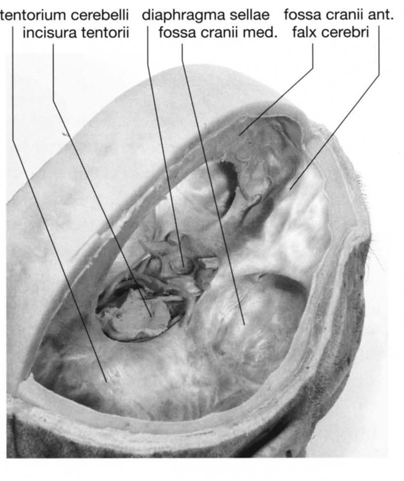 Hypofysen (lokalisation) Sella turcica (fossa hypophysialis) Dækket af diaphragma