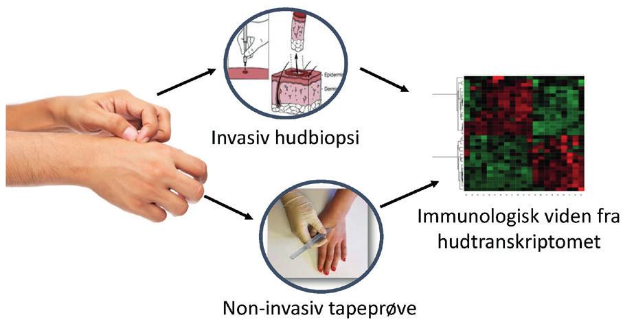 Tape-prøver er en ikke-invasiv metode til at tage prøver af det øverste hudlag og kan bruges til at undersøge de molekylære mønstre i huden.