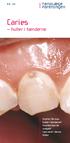N r. 2 0. Caries. huller i tænderne. Hvorfor får man huller i tænderne? Hvordan kan de undgås? Læs mere i denne folder