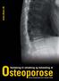 www.dkms.dk OVejledning til udredning og behandling af steoporose
