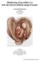 Håndtering af graviditet i en helt eller delvist dobbelt anlagt livmoder