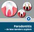 Parodontitis de løse tænders sygdom